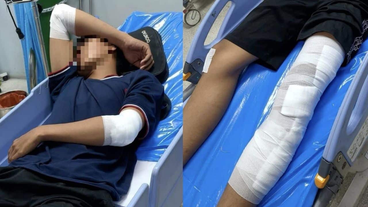 Foreigner wanted for hit-and-run that leaves teen in serious injuries