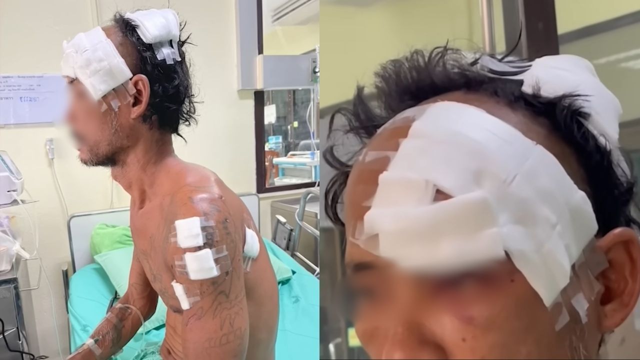 Thai man attacked by bear in Ratchaburi