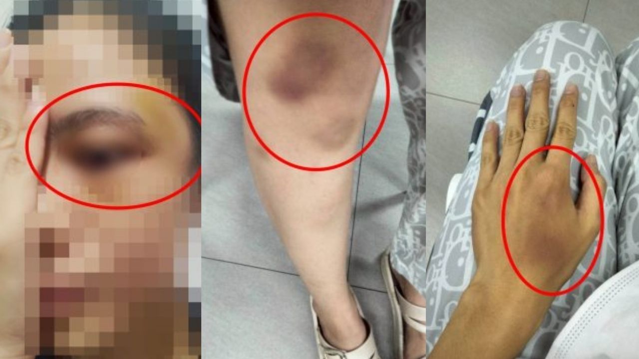 Thai woman abused by police boyfriend