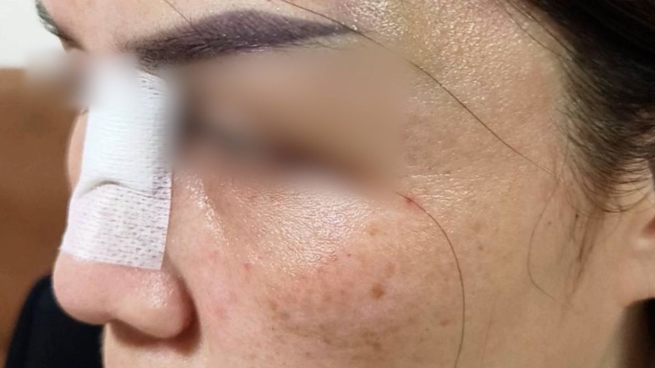 Thai woman injured in domestic violence