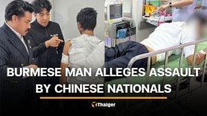 Burmese man sustains severe burns after alleged attack by 6 Chinese nationals | Thaiger