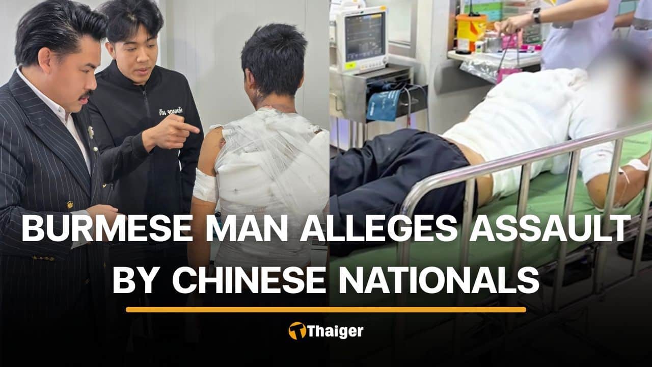 Burmese man sustains severe burns after alleged attack by 6 Chinese nationals | Thaiger