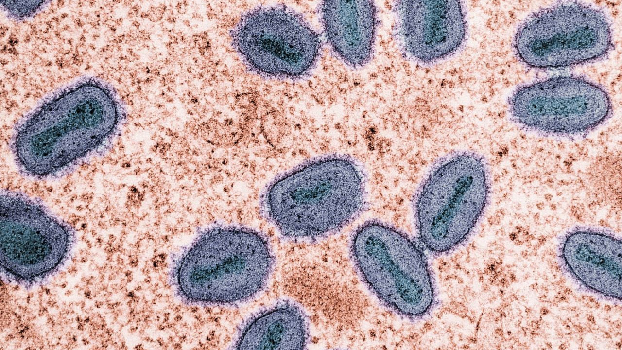Mpox cases in Thailand have reached 48 this year, with health officials monitoring possible infections after the Songkran period.