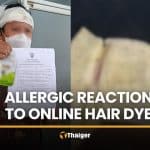 Online hair dye leaves Ratchaburi man with severe allergic reaction | Thaiger