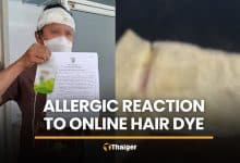 Online hair dye leaves Ratchaburi man with severe allergic reaction | Thaiger