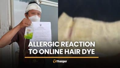 Online hair dye leaves Ratchaburi man with severe allergic reaction | Thaiger