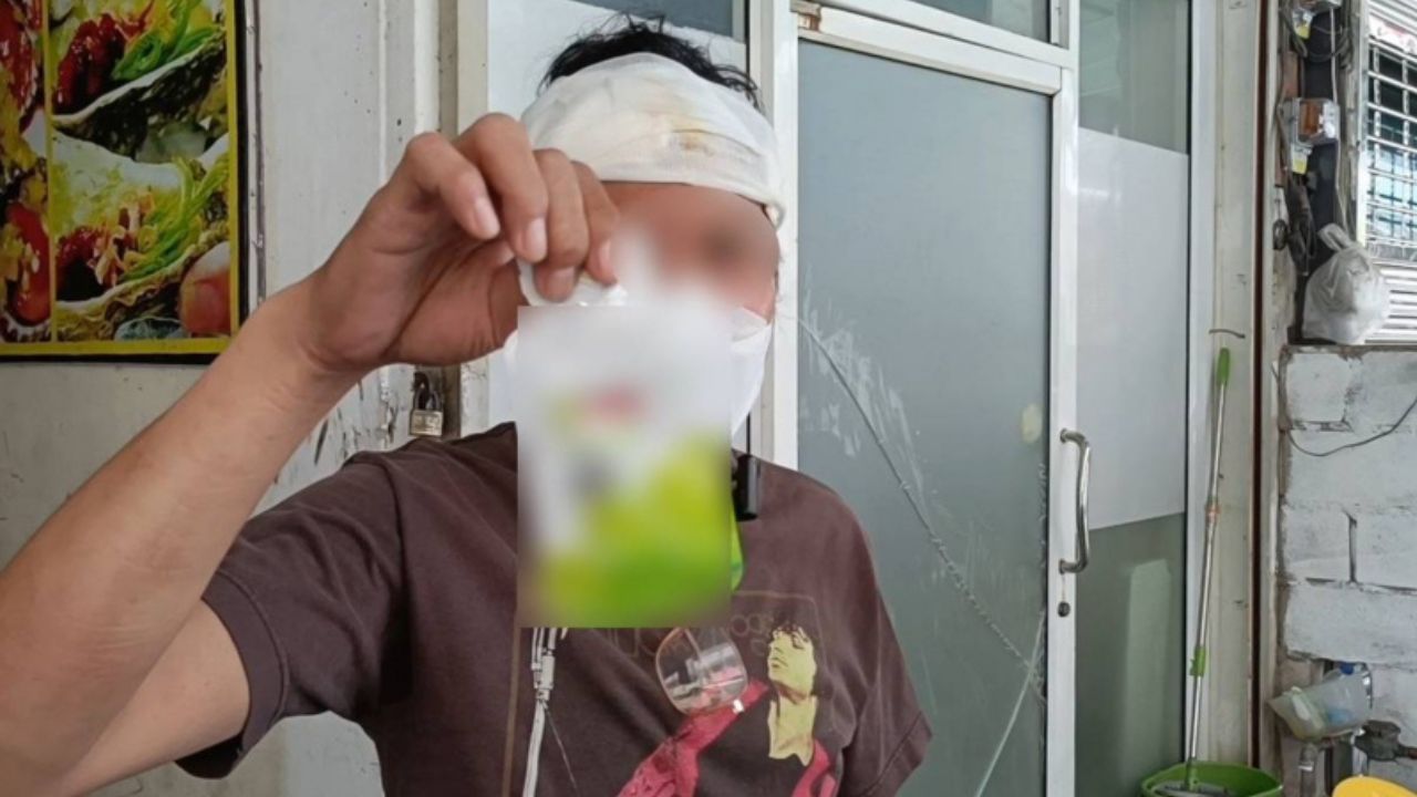 A Ratchaburi man warned consumers to check online hair dye products after suffering a severe allergic reaction from an unregistered product.